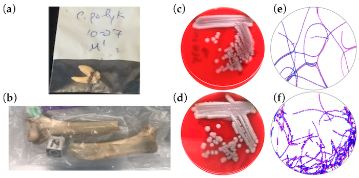 Six images are shown, with the top and bottom rows being compared to each other. On the left are pictures of a bone. In the middle are pictures of  an agar plates. On the right are Gram’s stains.